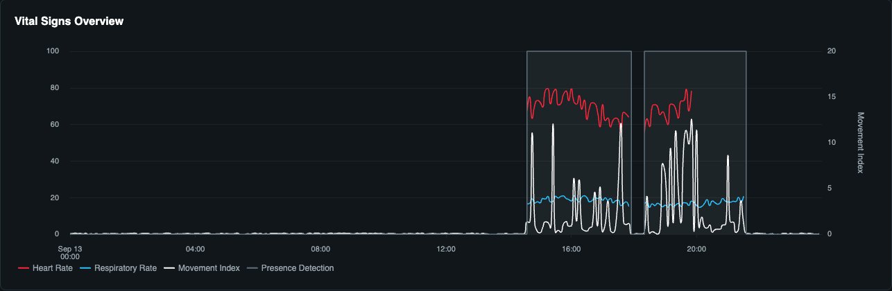 Dashboard: one day of vital signs against presence in the room