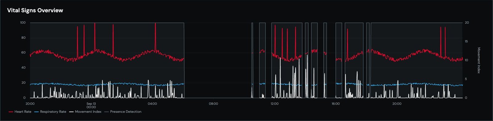 Dashboard: one night of heart rate, breathing rate, movement and time in bed